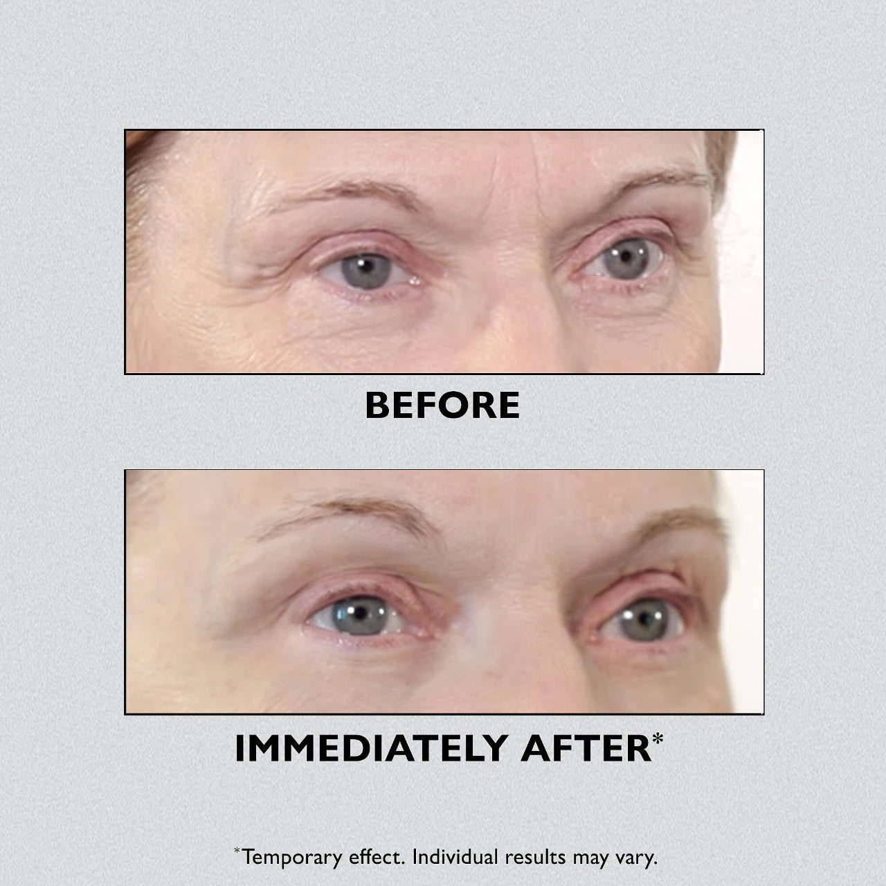 Peter Thomas Roth - Instant Temporary Eye Tightener