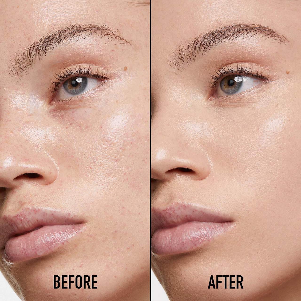 DIOR - Forever Skin Correct Full-Coverage Concealer - 1.5 NEUTRAL