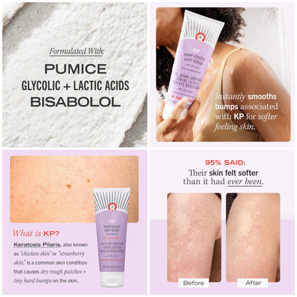 First Aid Beauty - KP Bump Eraser Body Scrub with 10% AHA