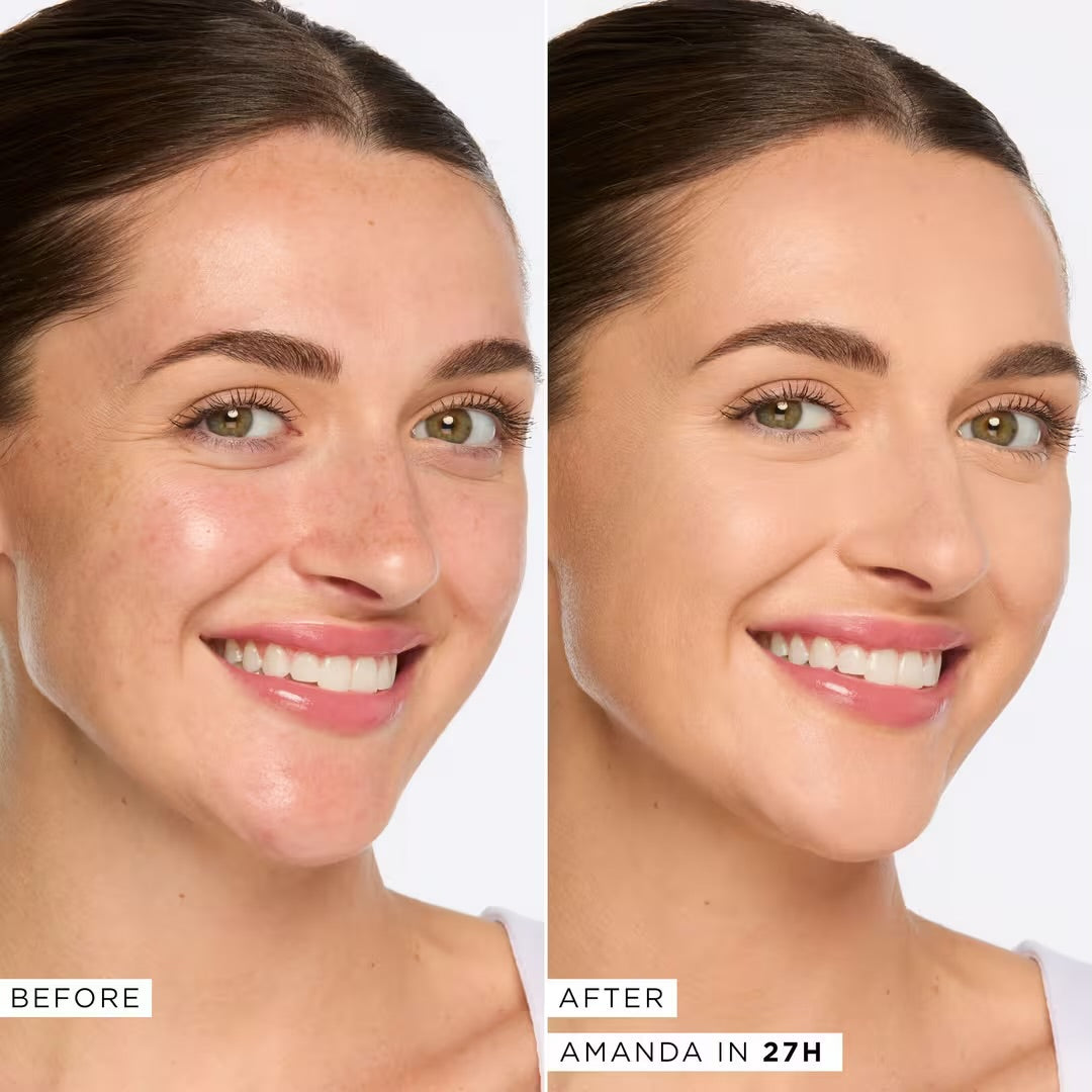 Tarte - Shape Tape Full Coverage Concealer - 27H LIGHT MEDIUM HONEY